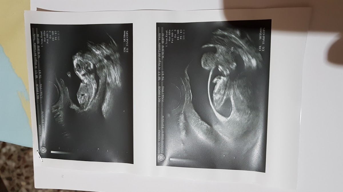 Clínica EVA Fertilidad y Reproducción Asistida