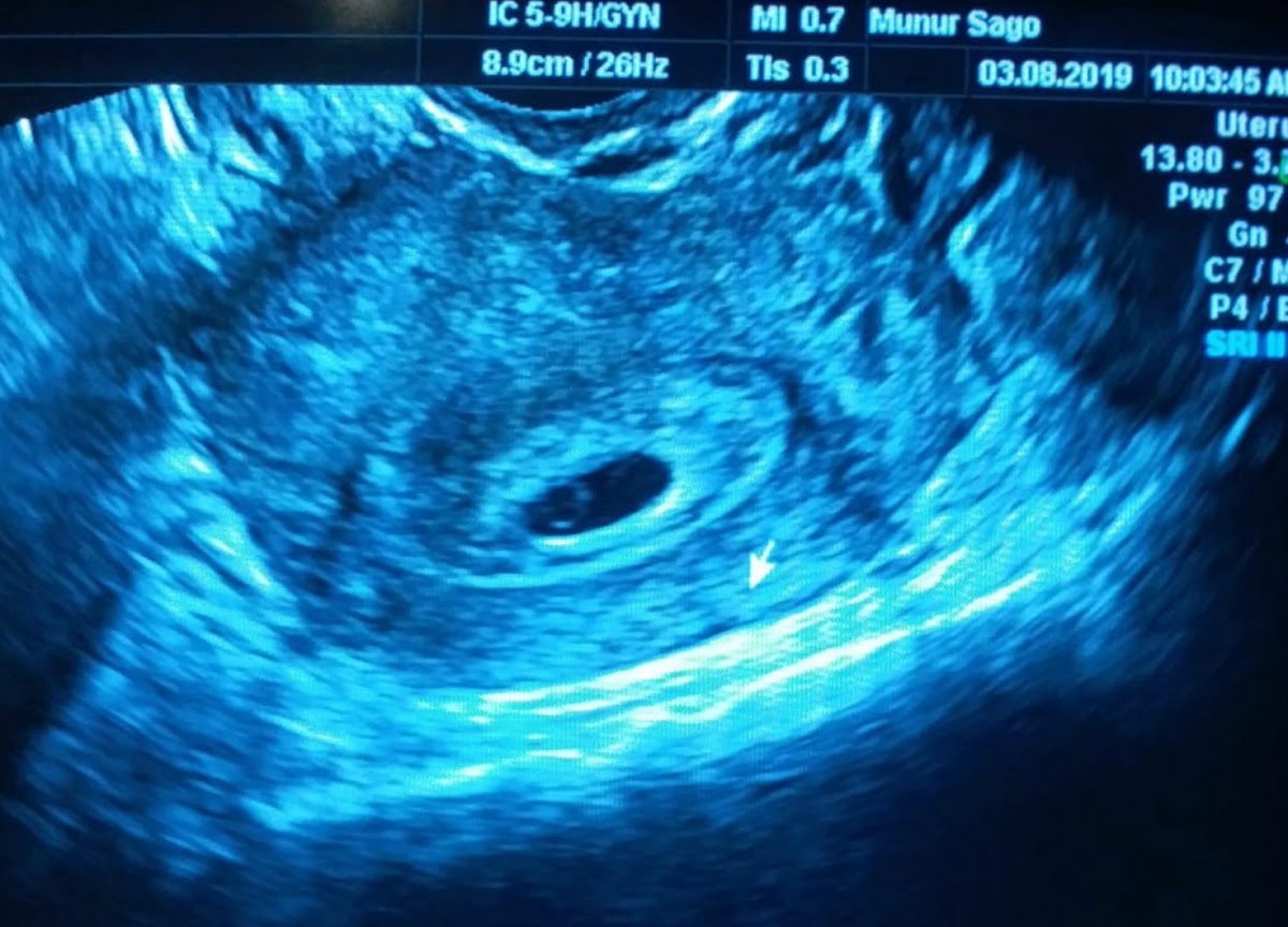 Sago IVF Team – Dr. Münür Şago