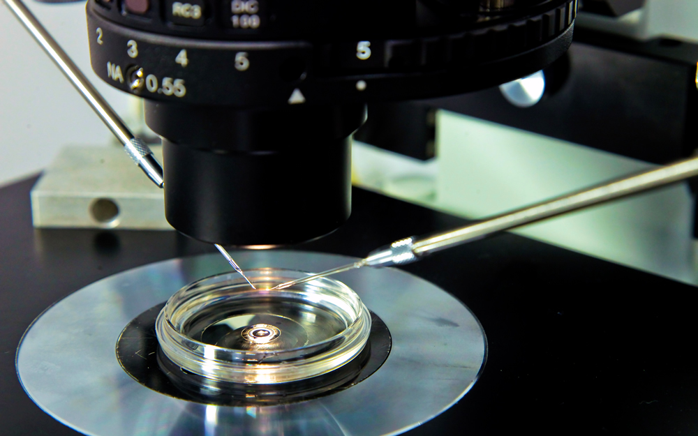 AMP Center St Roch – In vitro fertilization (IVF)