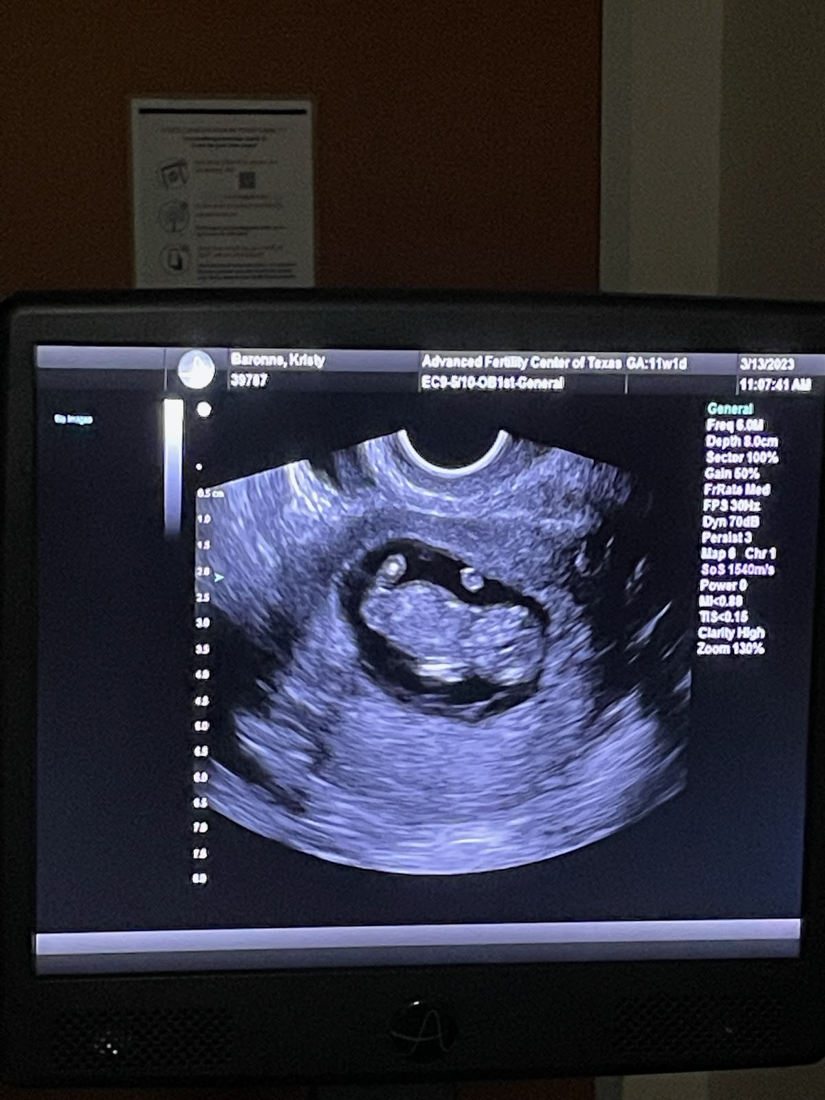 Advanced-Fertility-Center-of-Texas-5