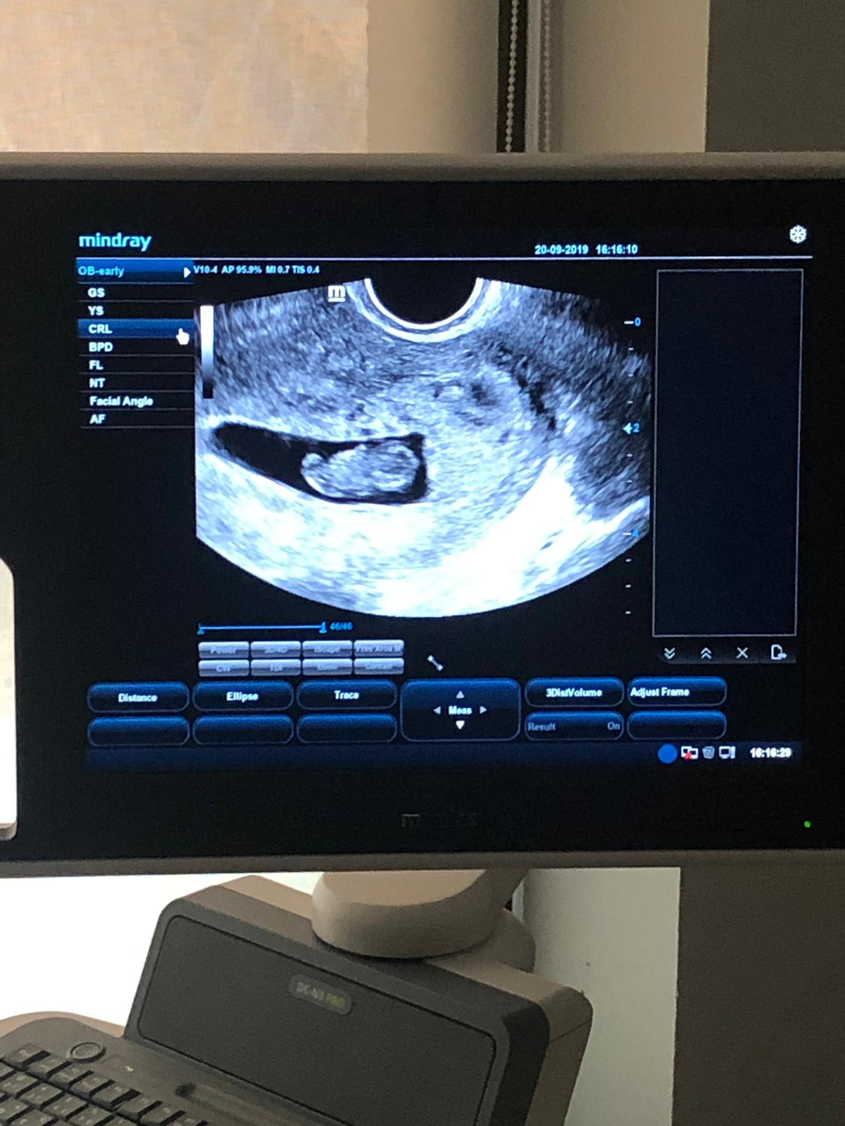 Clinica-EVA-Fertilidad-y-Reproduccion-Asistida-75