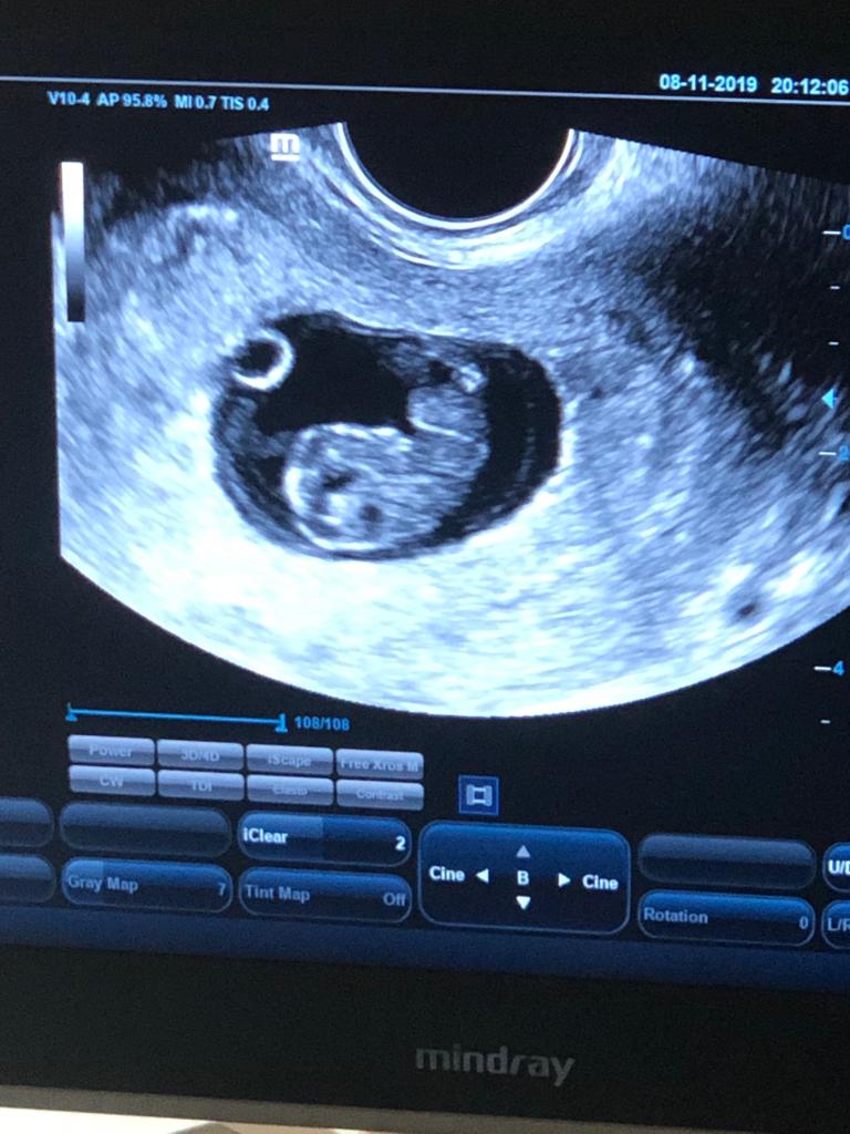 Clinica-EVA-Fertilidad-y-Reproduccion-Asistida-76