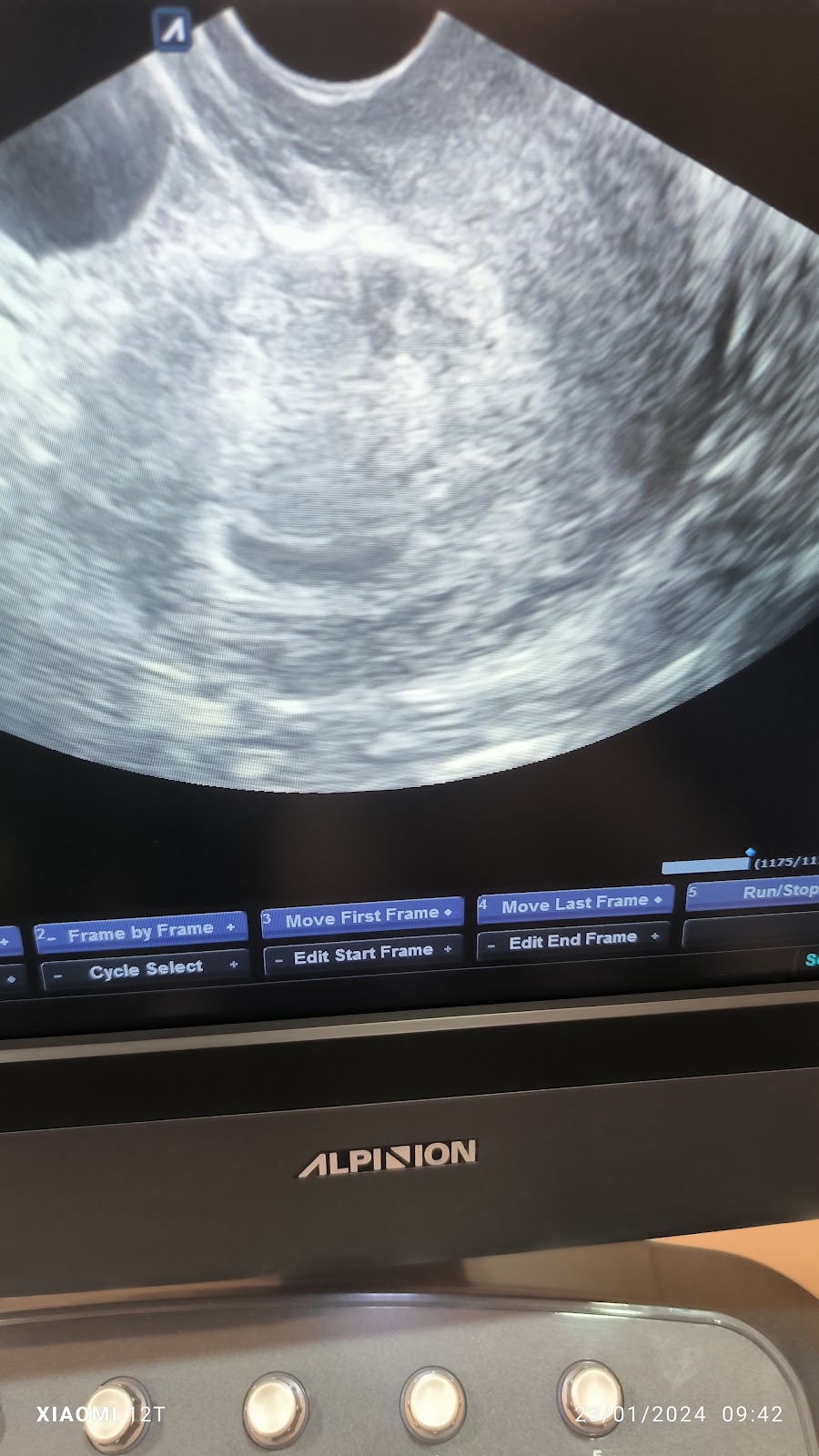 Dr.-dr.-Adek-Amansyah-M.Biomed-Sp.O.G-Subsp.F.E.R-Spesialis-Kebidanan-8211-Subspesialis-Fertilitas-Endokrinologi-Reproduksi-2