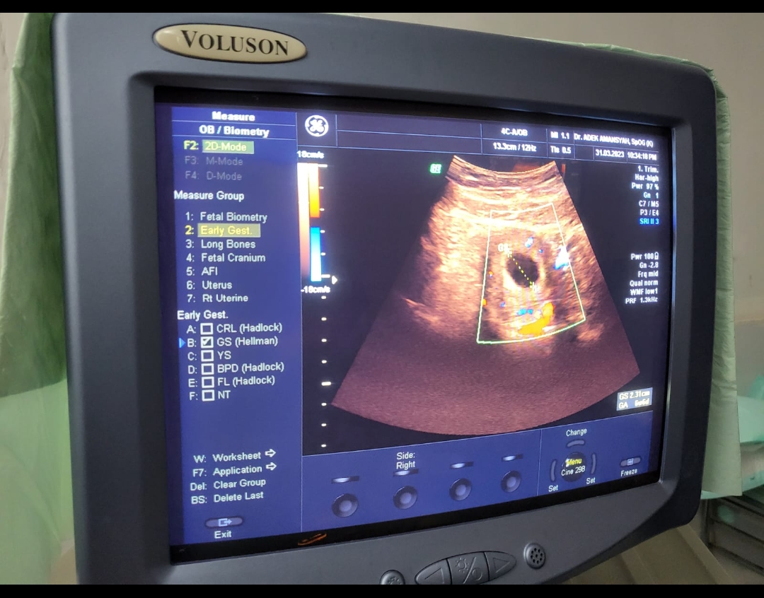 Dr.-dr.-Adek-Amansyah-M.Biomed-Sp.O.G-Subsp.F.E.R-Spesialis-Kebidanan-8211-Subspesialis-Fertilitas-Endokrinologi-Reproduksi-3