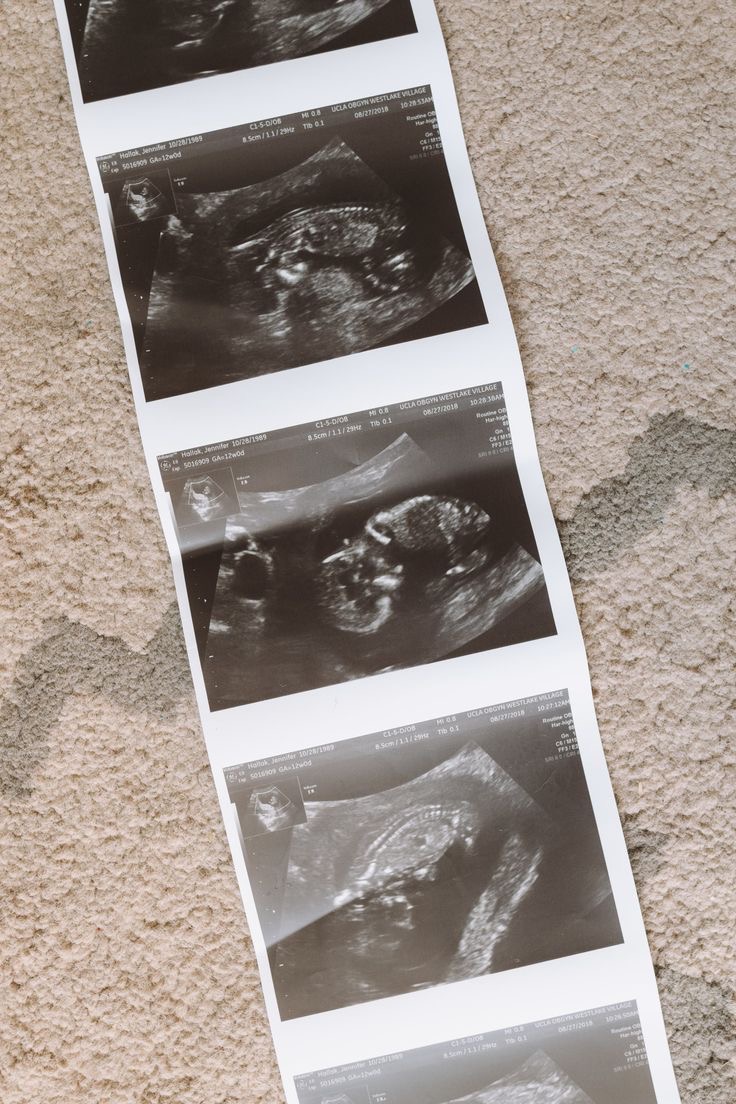 HermanFamily-fertility-amp-law-3