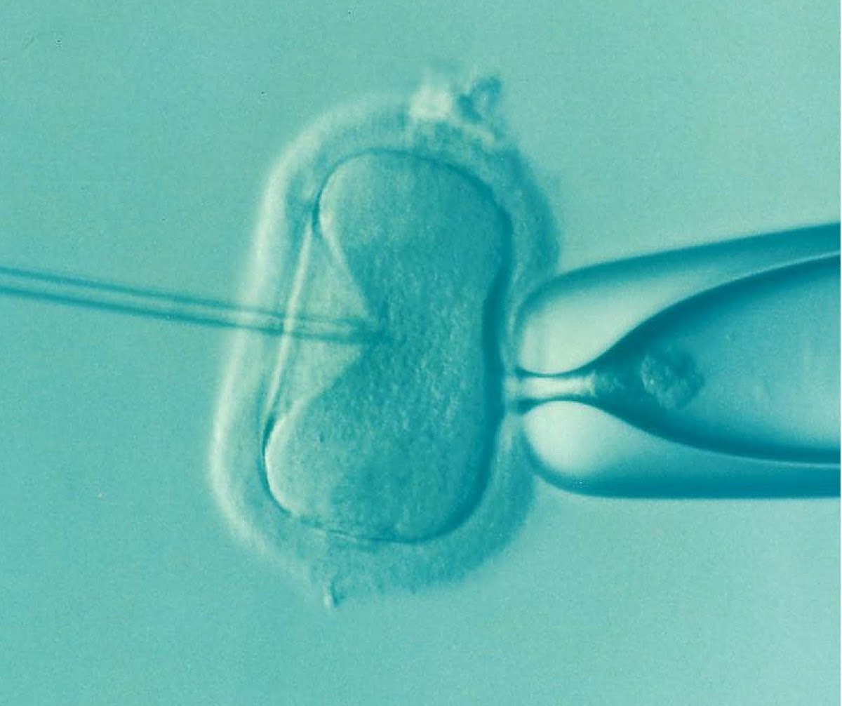 Hull & East Riding Fertility