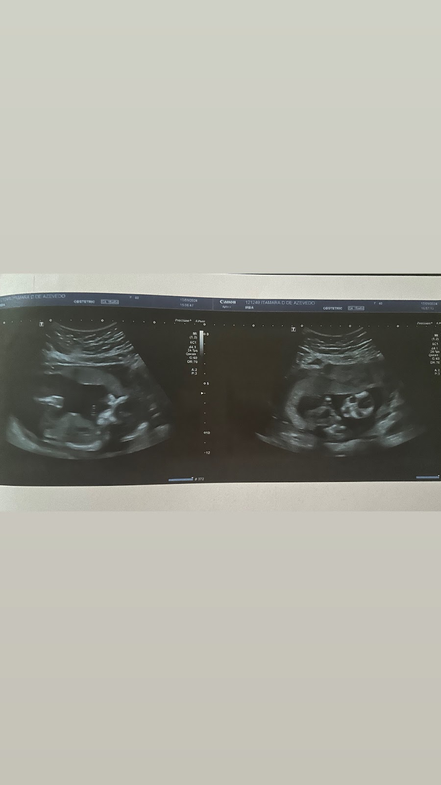 IVI-Salvador-8211-Clinica-de-Reproducao-Humana-3