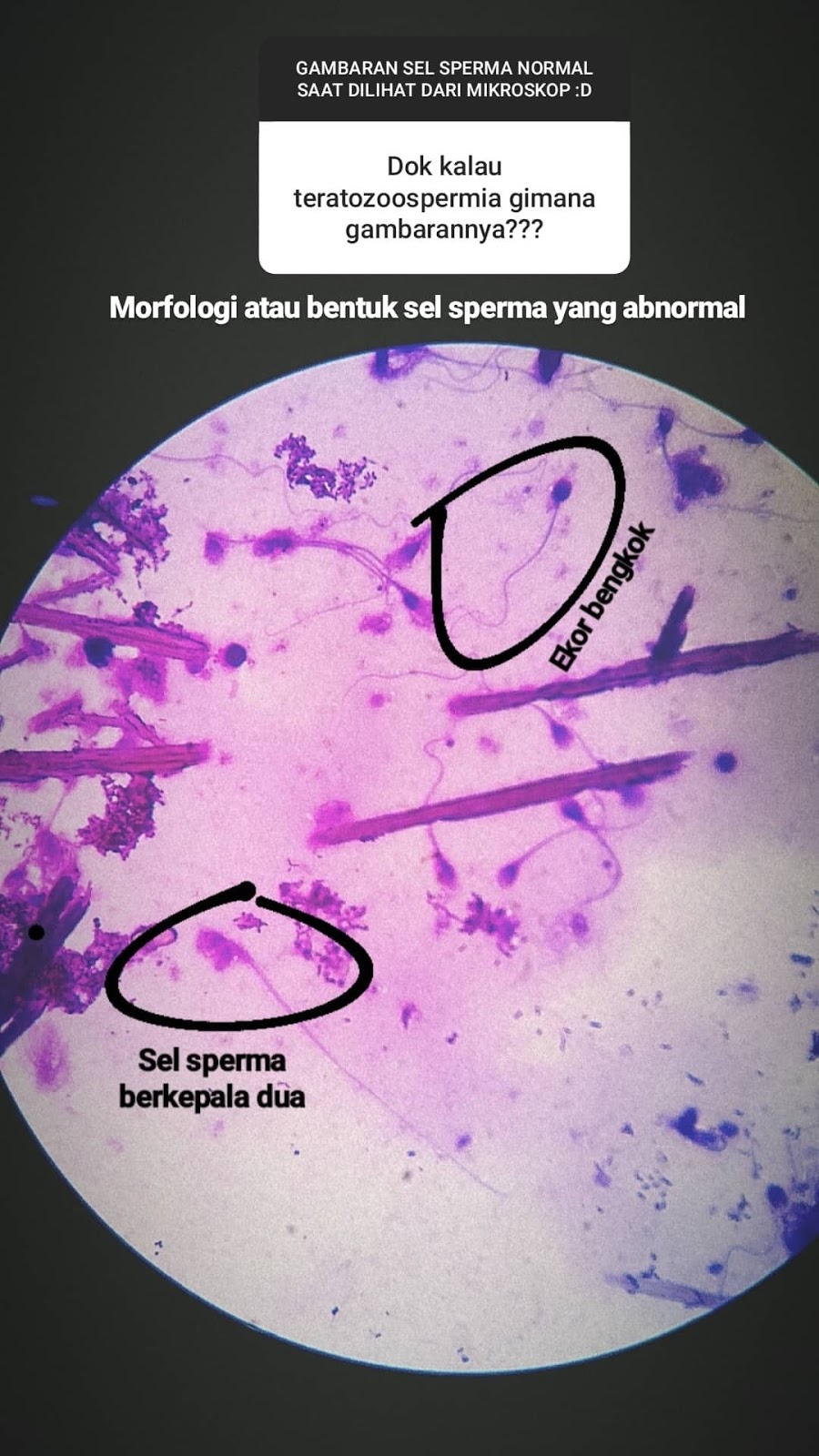 Klinik-Fertilitas-amp-Bayi-Tabung-Tiara-Cita