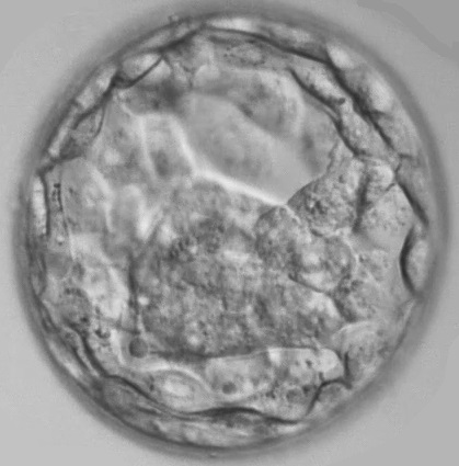 Leicester-Fertility-Centre-3