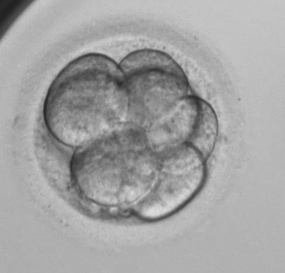 Leicester-Fertility-Centre-4