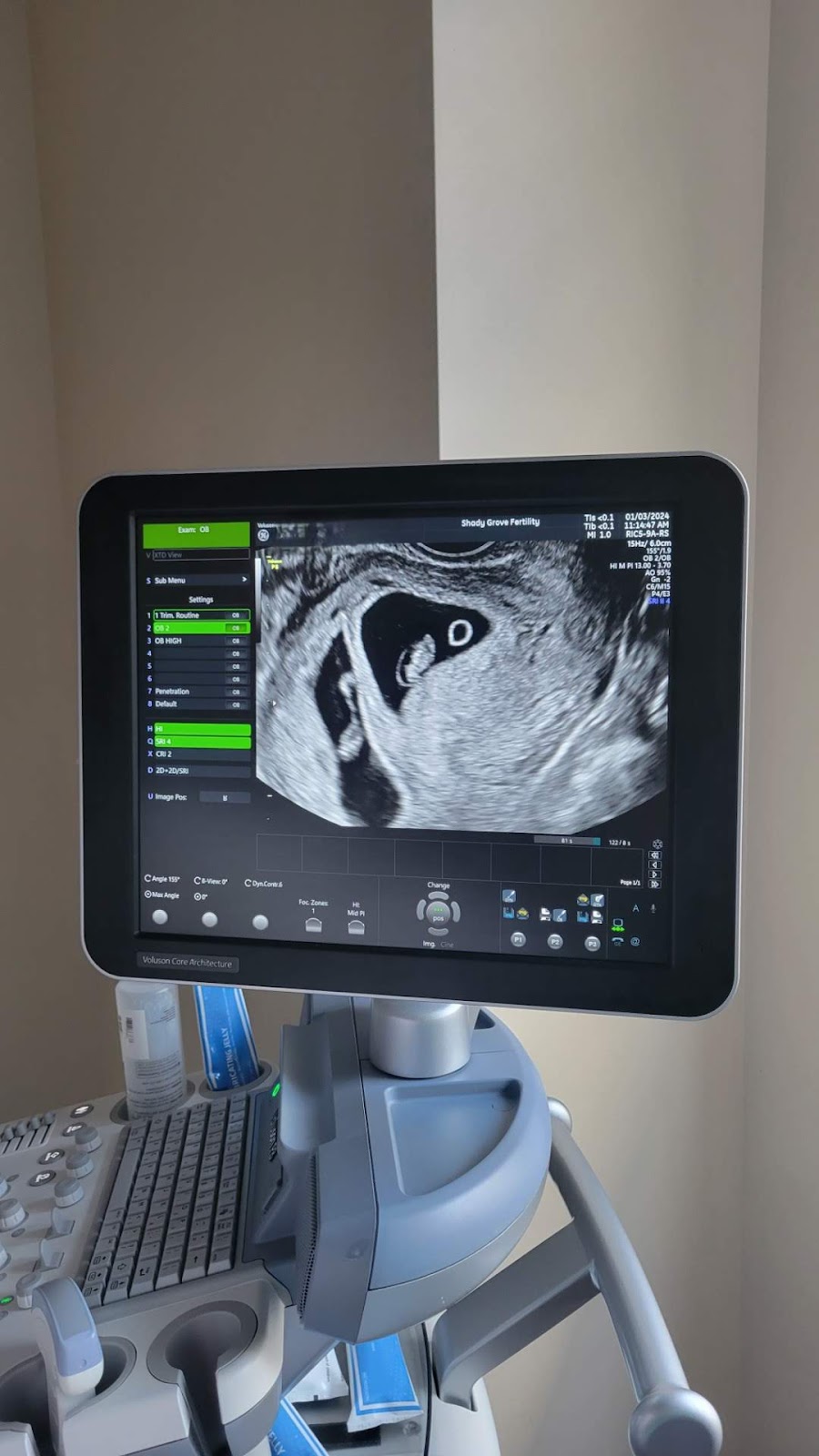 Shady-Grove-Fertility-in-Bethlehem-PA-2